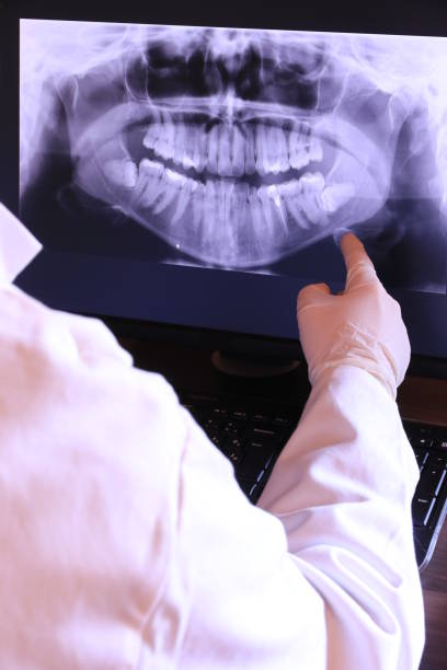 Best Emergency Wisdom Tooth Extraction in Rutledge, GA